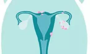 Primary Ovarian Insufficiency Associated With Increased Risk Of Osteoporosis