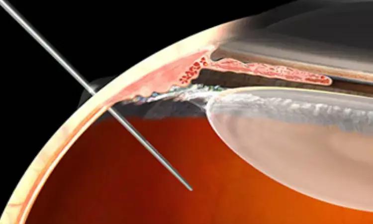 Intravitreal Steroids And Anti-VEGF Therapy Beneficial In Treatment Of Resistant Wet-AMD
