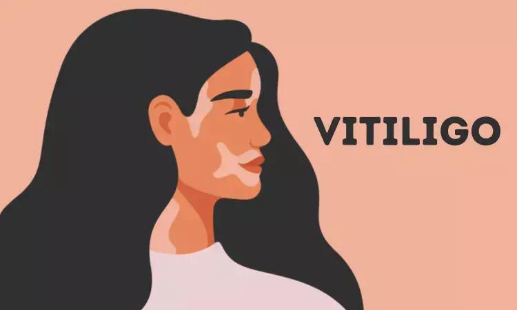 Povorcitinib Showcases Substantial Total Body And Facial Repigmentation In Vitiligo In Phase 2b Trial