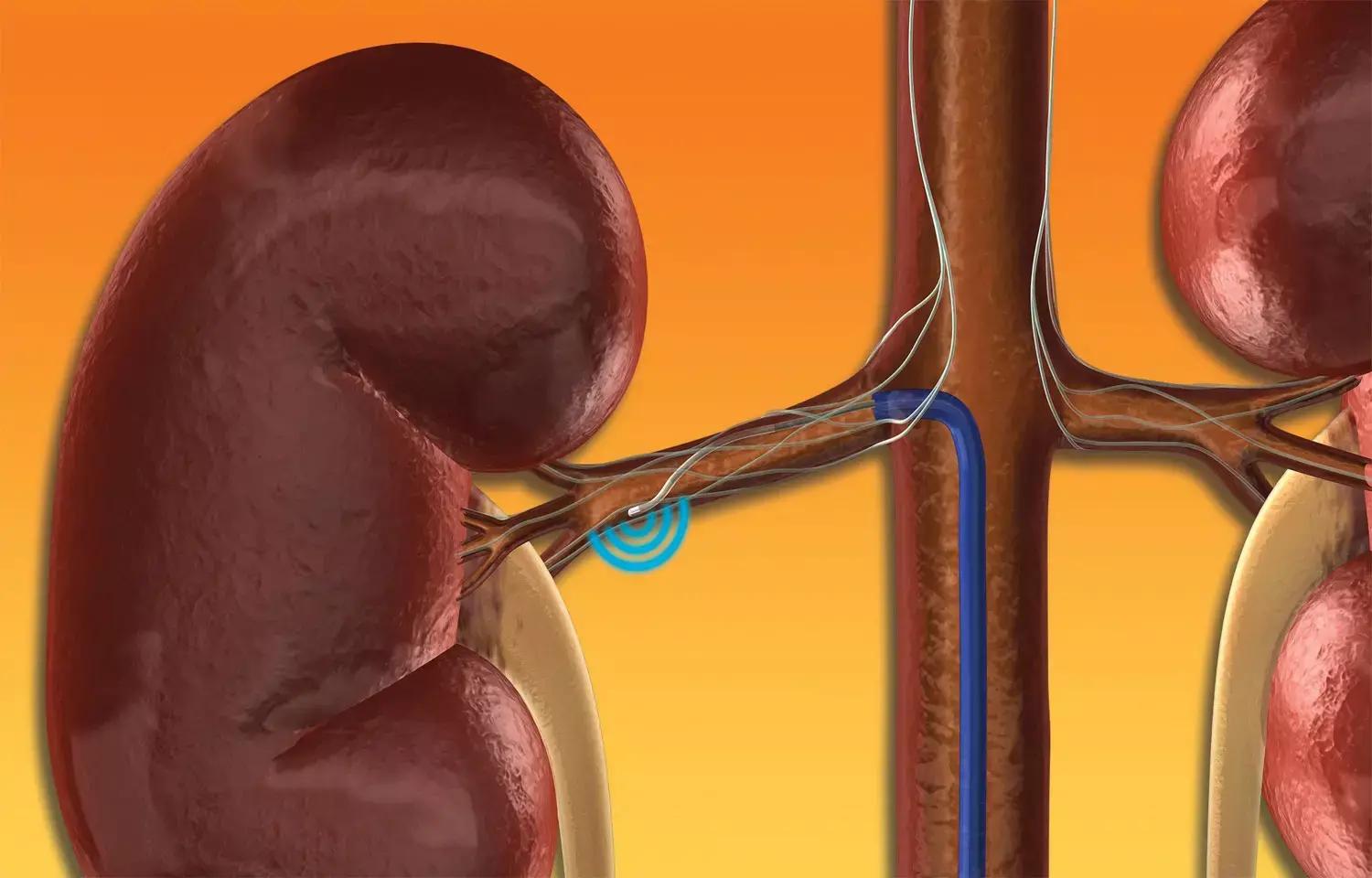 Renal Denervation Benefits Last Upto 3 Years In Patients On BP Medicines : SPYRAL HTN ON