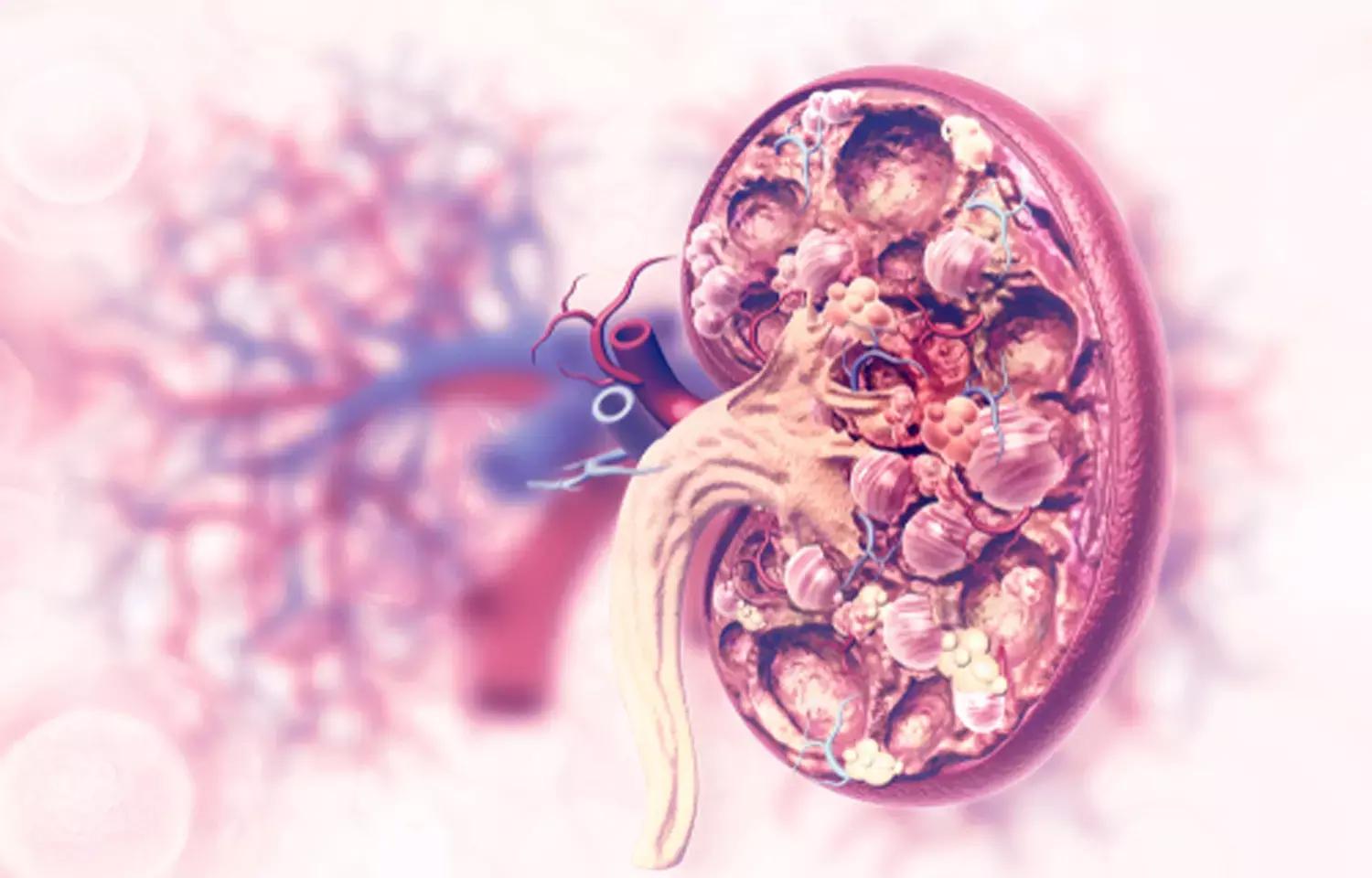 Low-Dose Prednisolone Effective For Remission Of Lupus Nephritis: Study