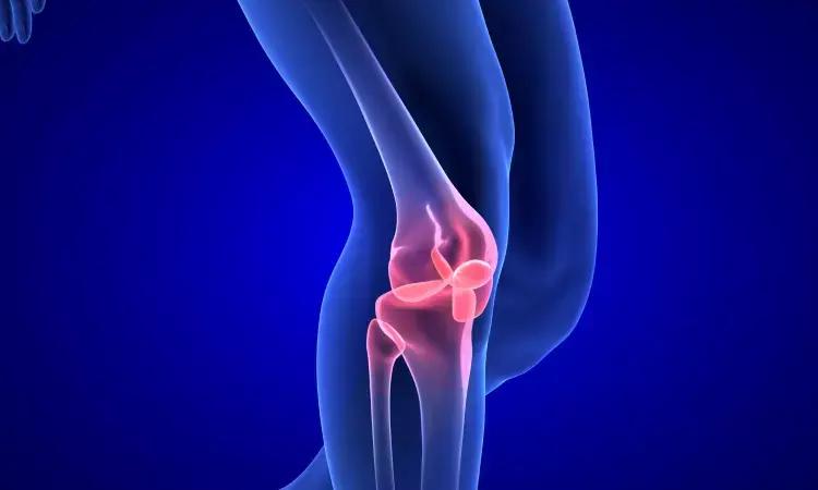 Comorbid Obesity Big Hurdle For Achieving Remission Among Patients With Psoriatic Arthritis