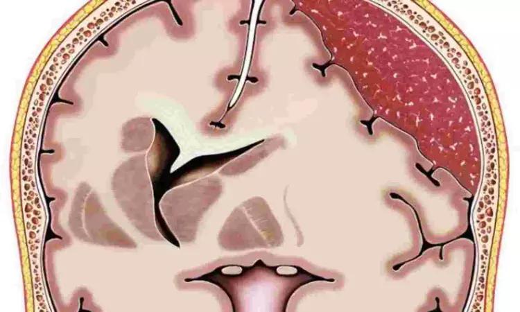 Surgery Or Glucocorticoid Treatment-Which Is Better For Chronic Subdural Hematoma?