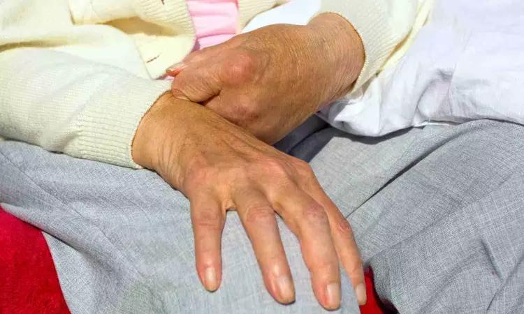 'Smart Glove' Helps In Better Hand Mobility Of Stroke Patients