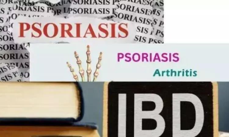 Bidirectional Dual Causality Found Between Psoriasis And Crohn'S Disease In New Study