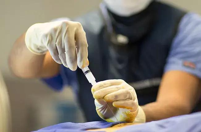 Secondary Antibiotic Prophylaxis With Penicillin Reduces Rheumatic Heart Disease Progression: NEJM