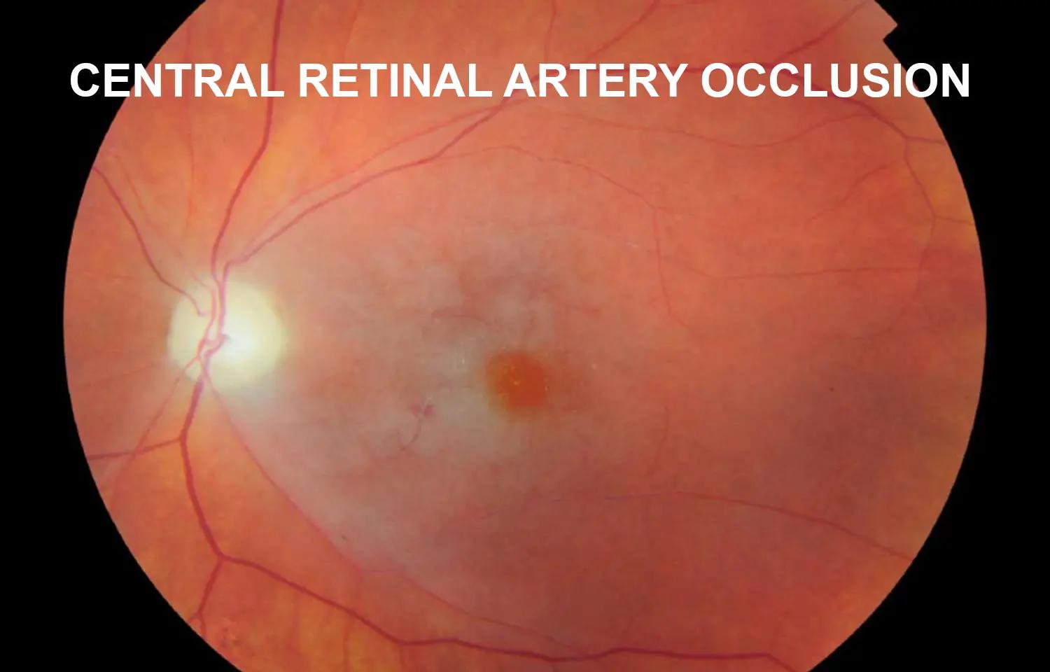 Intravenous Thrombolysis Feasible Proposition For Central Retinal Artery Occlusion