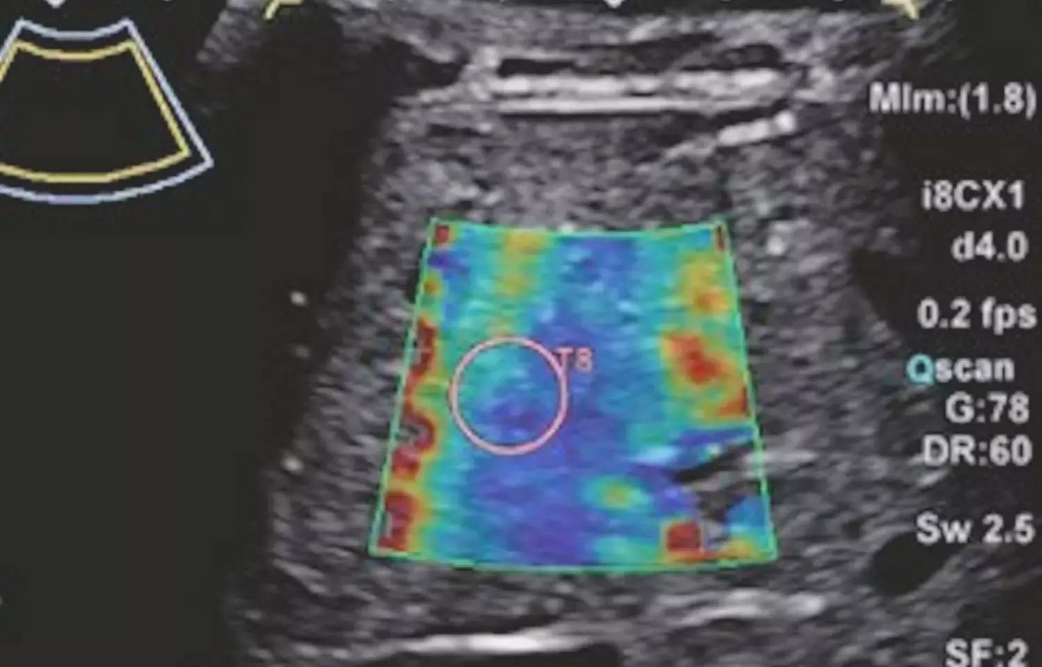 For Liver Disease In Children, Ultrasound Correlates Well With MRI: Study